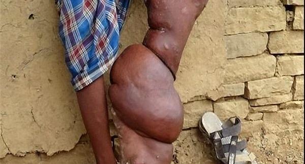 عکس حشره ویروسی هند
