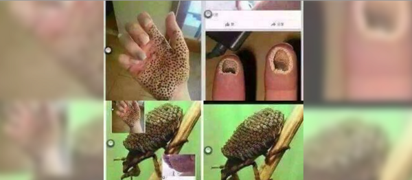 عکس حشره ویروسی هند
