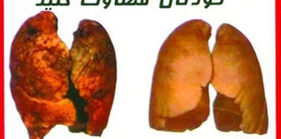عکس ریه روی پاکت سیگار