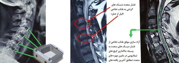 عکس ام ار ای از گردن