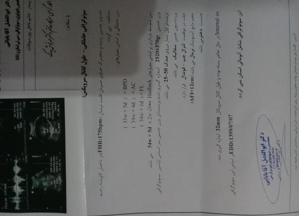 عکس ضربان قلب جنین دختر