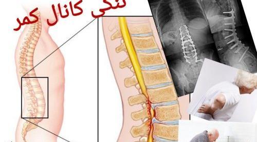 ستون فقرات عکس ام ار ای دیسک کمر سالم