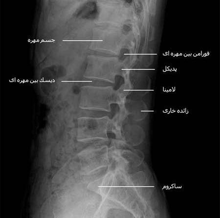 ستون فقرات عکس ام ار ای دیسک کمر سالم