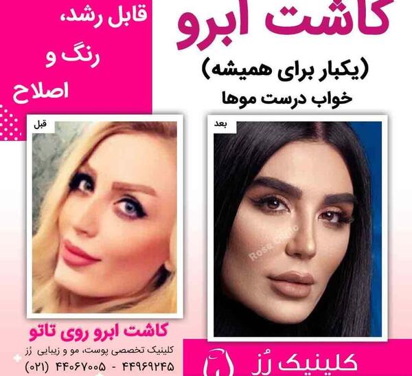 عکس کاشت ابرو بعد از چند ماه