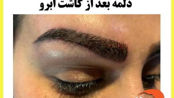 عکس کاشت ابرو بعد از چند ماه