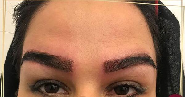 عکس کاشت ابرو بعد از چند ماه