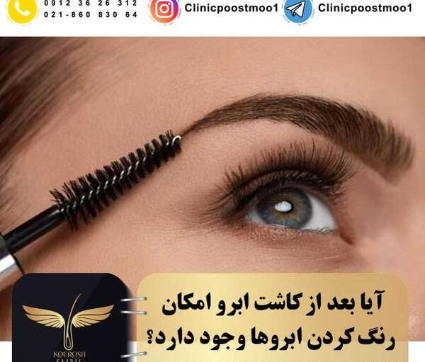 عکس کاشت ابرو بعد از چند ماه