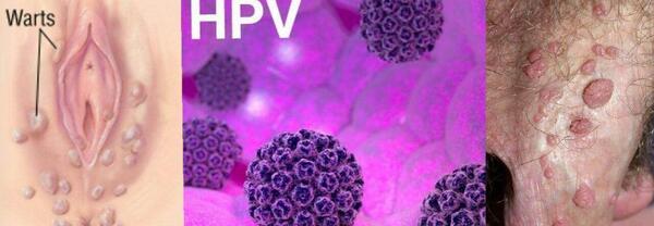 عکس ویروس hpv