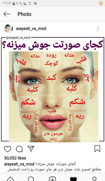 عکس لب جوش