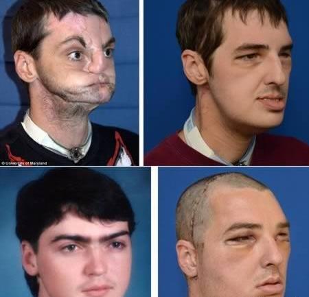 عکس های وحشتناک صورت