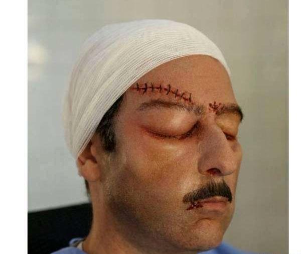 عکس های وحشتناک صورت