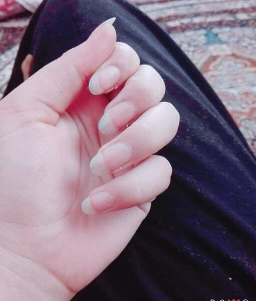 عکس ناخن یهویی