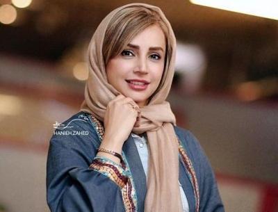 عکس احسان علیخانی قبل کاشت مو