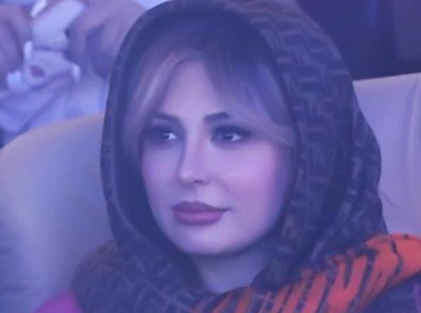 عکس لب نیوشا ضیغمی