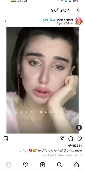 عکس قبل از عمل نیکا