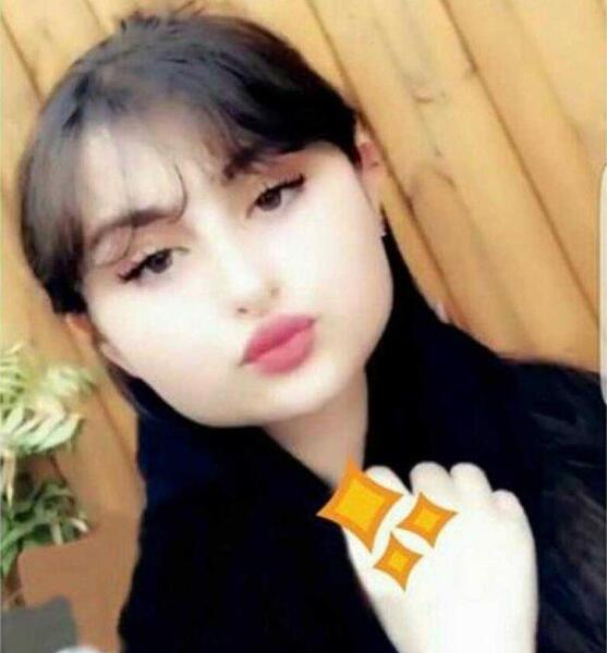 عکس قبل از عمل نیکا