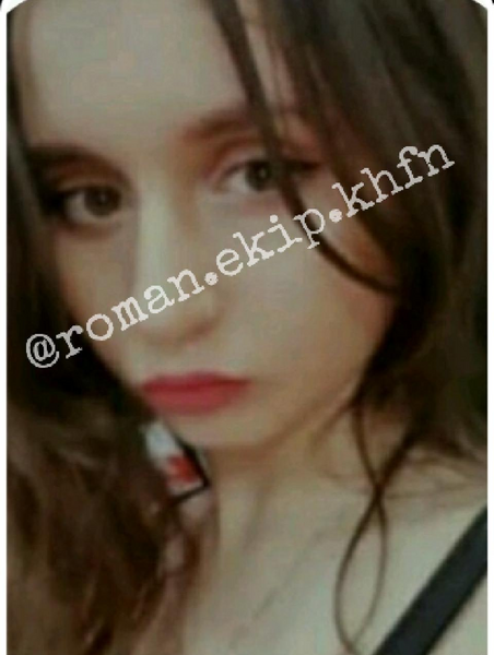 عکس قبل از عمل نیکا