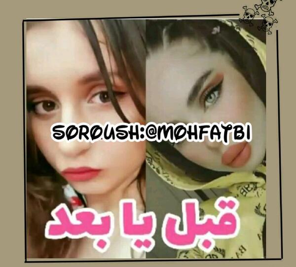عکس قبل از عمل نیکا