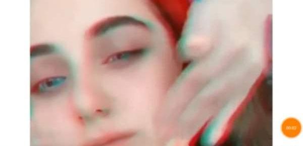 عکس قبل از عمل نیکا