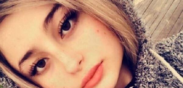 عکس قبل از عمل نیکا
