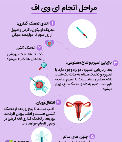 عکس آی وی اف