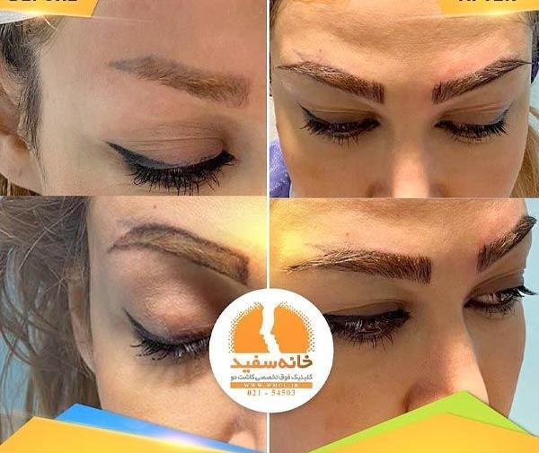 عکس کاشت ابرو روی تاتو