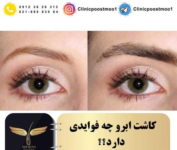 عکس کاشت ابرو روی تاتو
