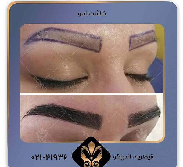 عکس کاشت ابرو روی تاتو