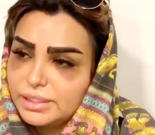 عکس کاشت ابرو روی تاتو