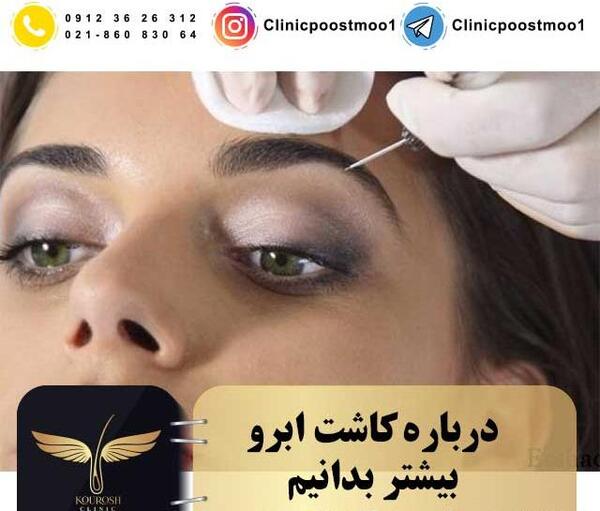 عکس کاشت ابرو روی تاتو