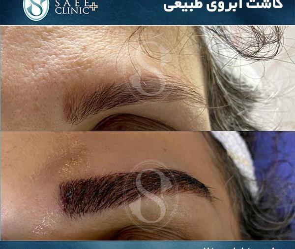 عکس کاشت ابرو روی تاتو