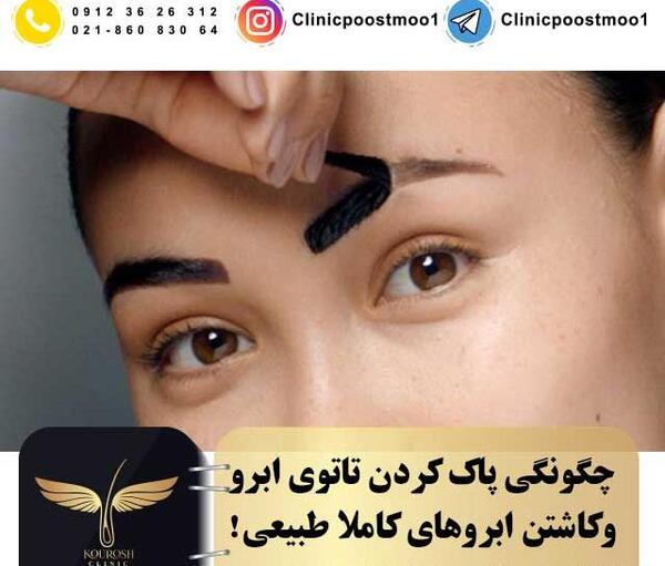 عکس کاشت ابرو روی تاتو