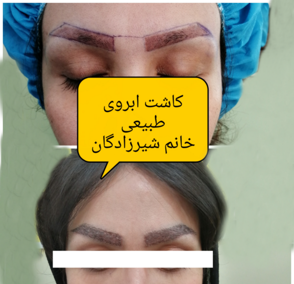 عکس کاشت ابرو روی تاتو