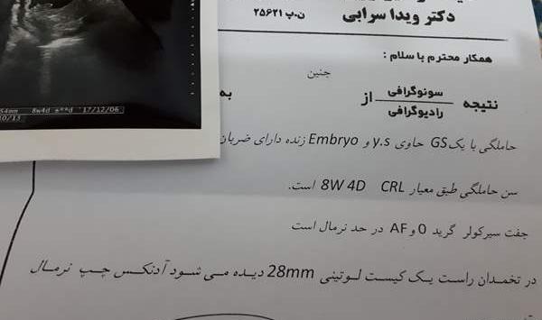عکس سونوگرافی ضربان قلب جنین