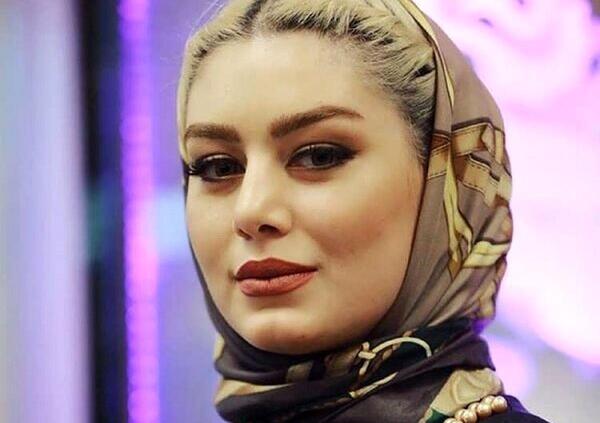 عکس سحر قریشی قبل از عمل بینی