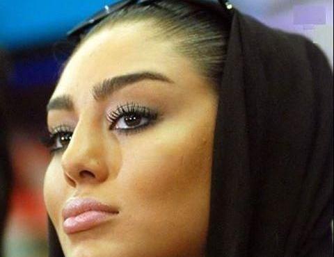 عکس سحر قریشی قبل از عمل بینی