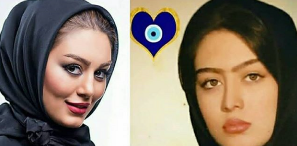 عکس سحر قریشی قبل از عمل بینی