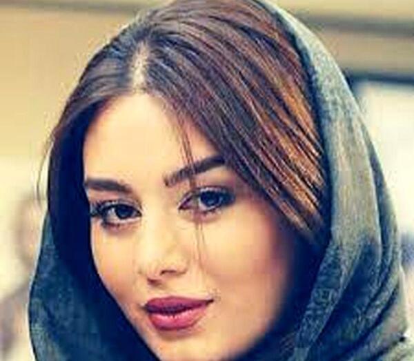 عکس سحر قریشی قبل از عمل بینی