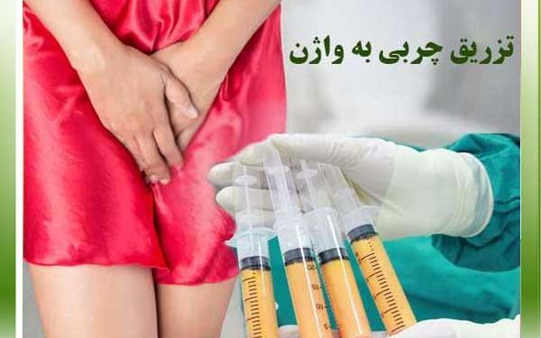 عکس تزریق ژل به واژن نی نی سایت