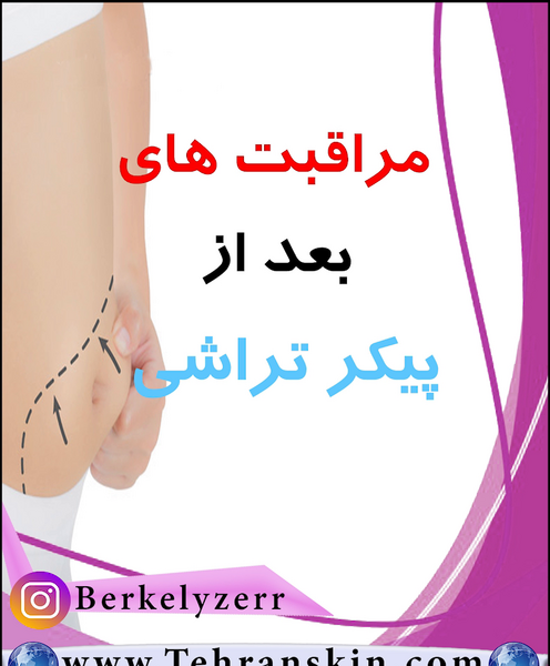 عکس تزریق ژل به واژن نی نی سایت
