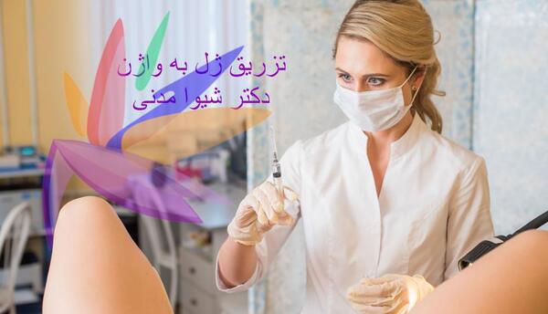 عکس تزریق ژل به واژن نی نی سایت
