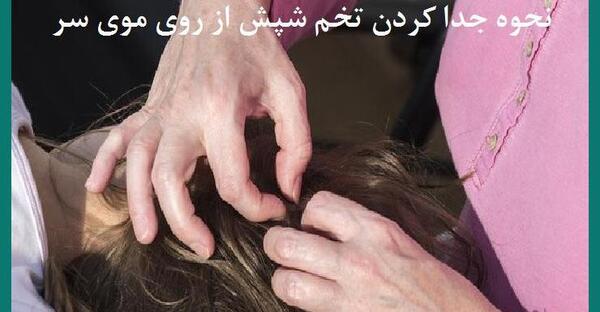 عکس بزرگترین شپش سر
