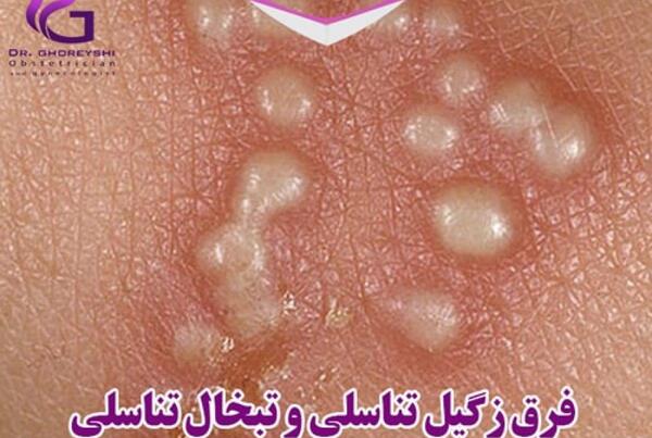 عکس ویروس hpv در زنان