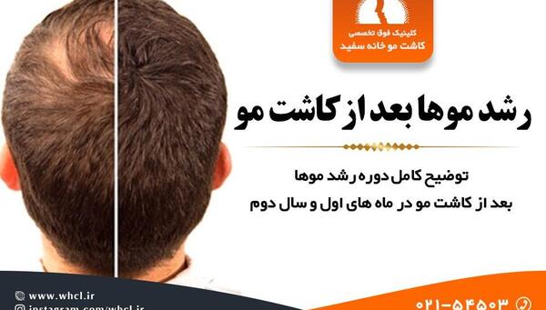 عکس کاشته شده