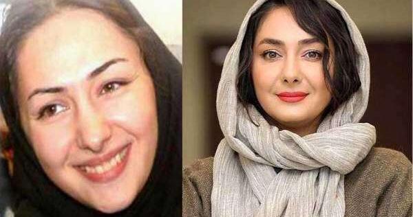 عکس صحنه ی قبل از عمل