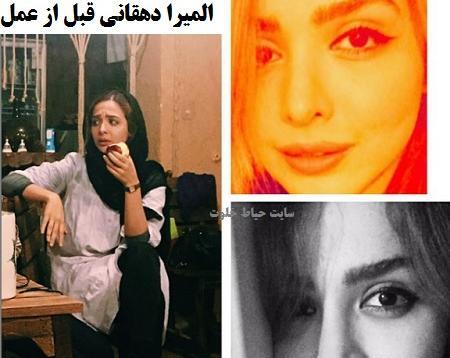 عکس صحنه ی قبل از عمل