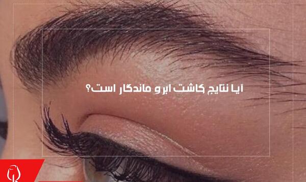 عکس کاشت ابرو بعد از یکسال