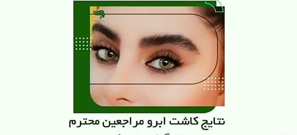 عکس کاشت ابرو بعد از یکسال