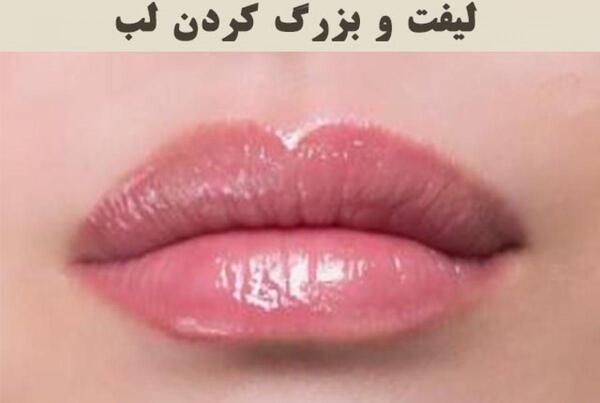 عکس لیفت لب
