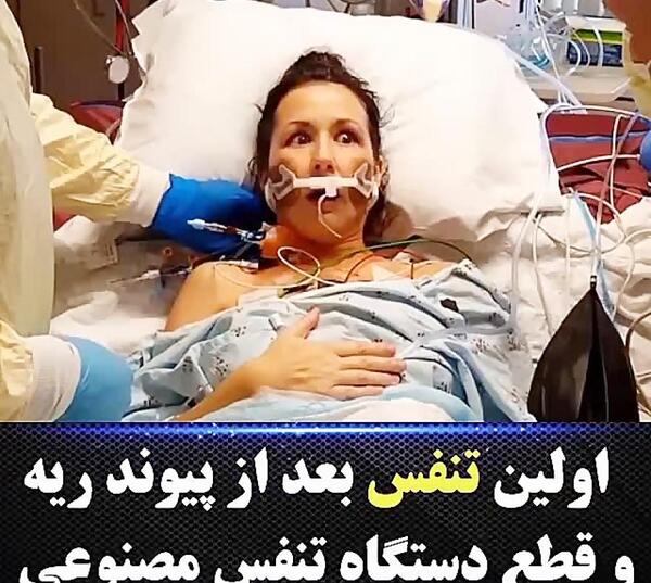 عکس عمل ریه